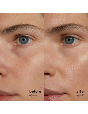 Retinol Alternative Sérum – Anti-âge naturel et sans irritation Retinol Alternative Sérum – Anti-âge naturel et sans irritation